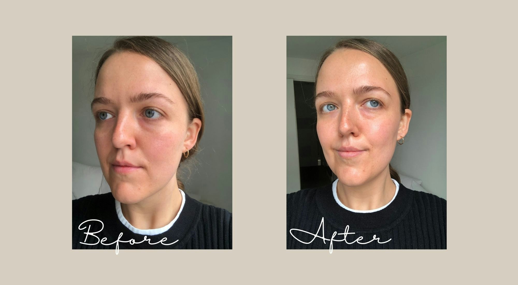 Facial aftermath